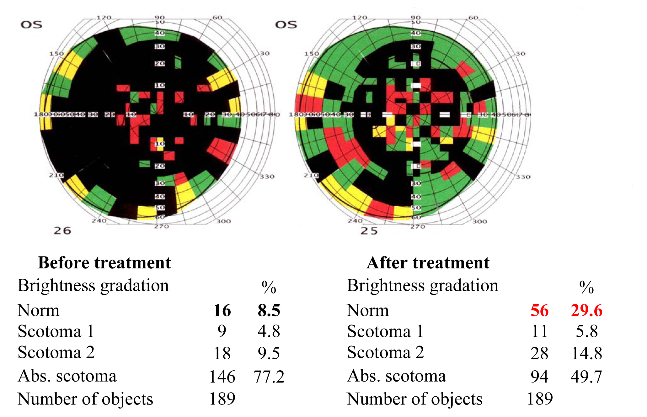 Results of the visual functions tests before and after the treatment course 2