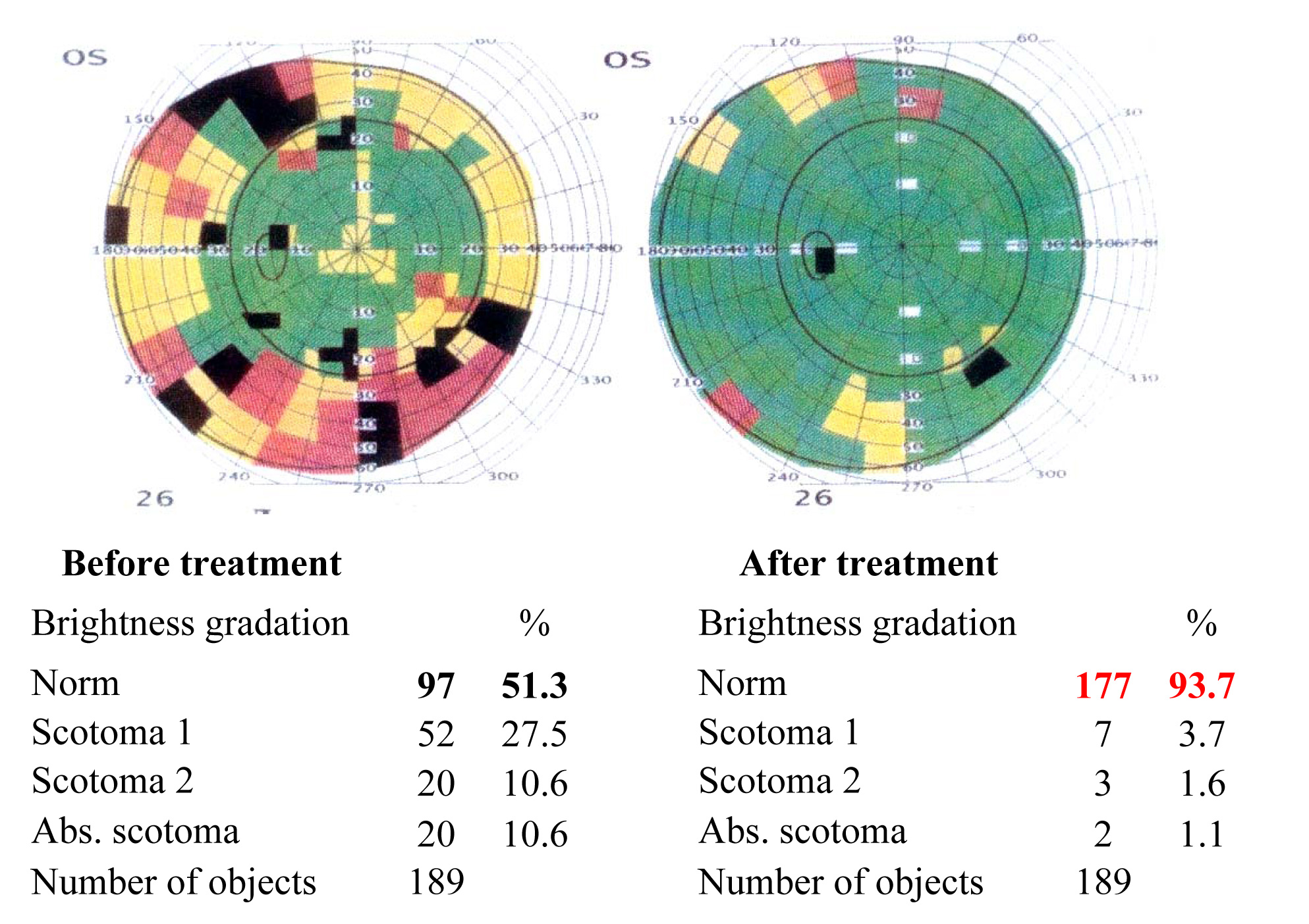 Results of the visual functions tests before and after the treatment course
