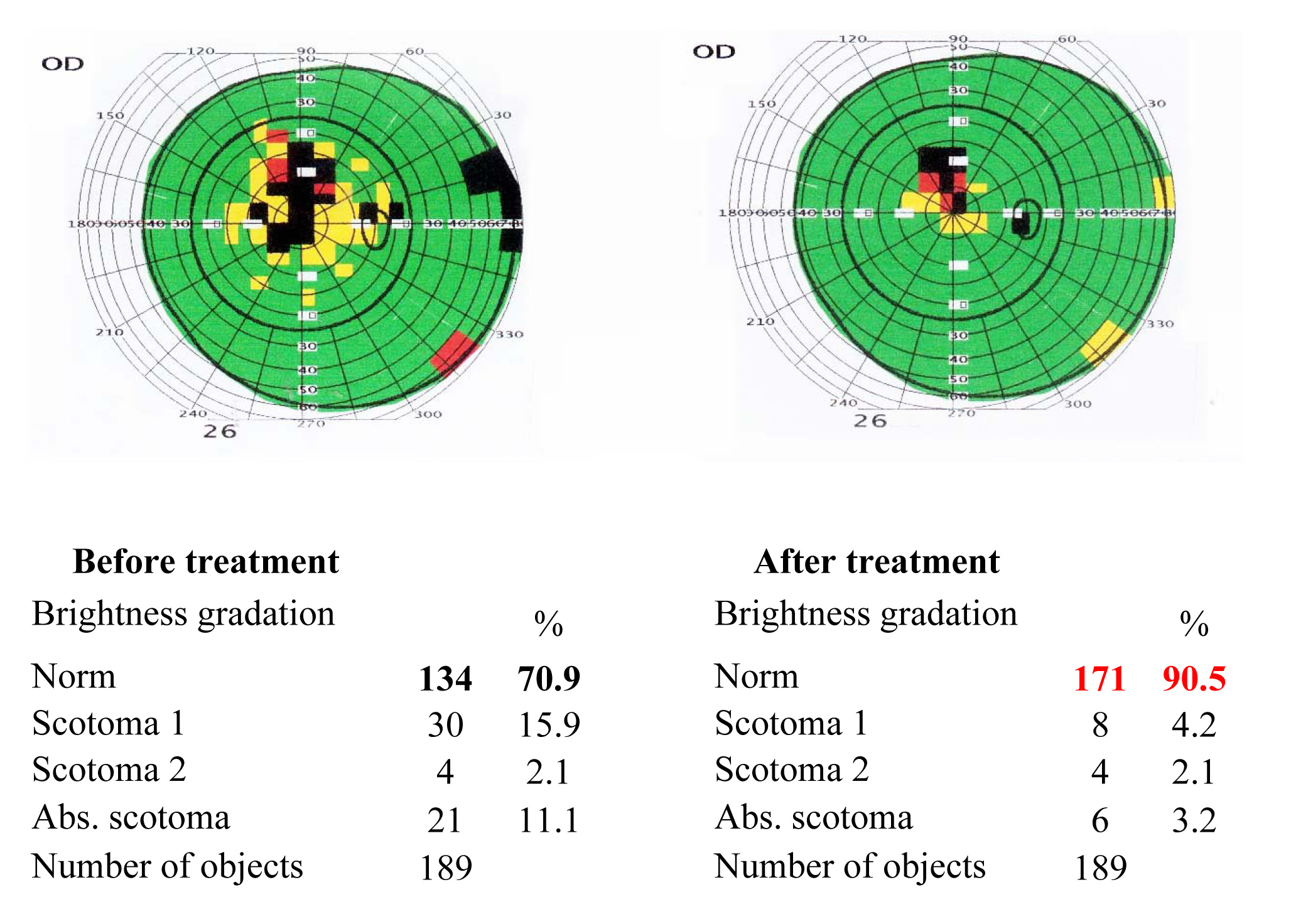 Results of the visual functions tests before and after the treatment course 3